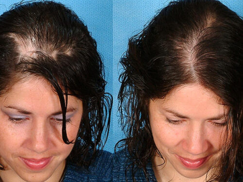 Biotin 10,000mcg photo review