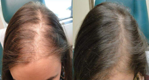 Biotin 10,000mcg photo review